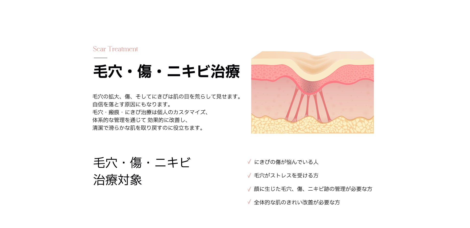 Scar Treatment