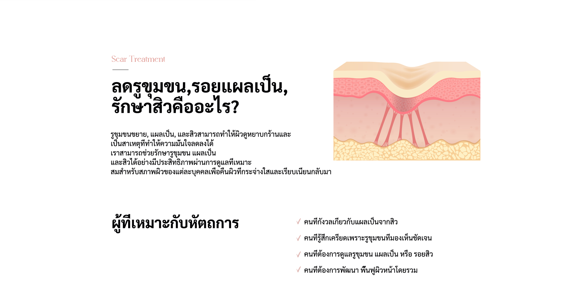 Scar Treatment