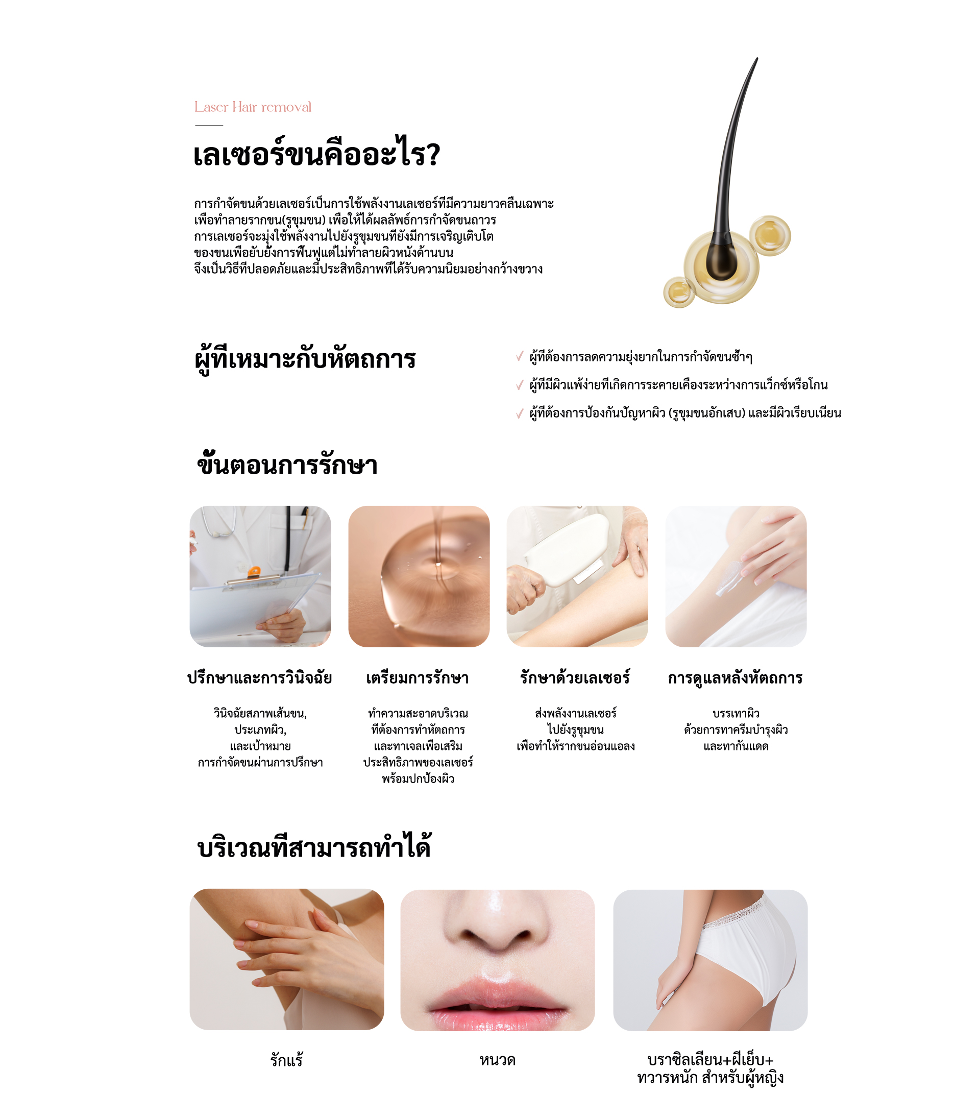 Laser hair removal